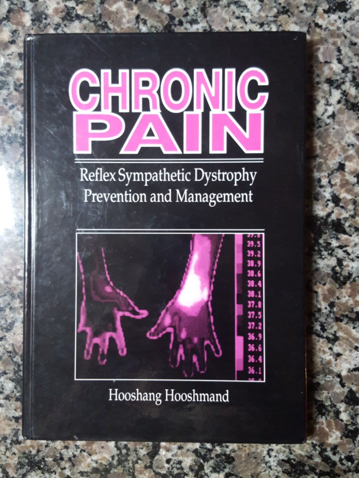 Chronic Pain: Reflex Sympathetic Dystrophy, Prevention, and Management by Hoosha