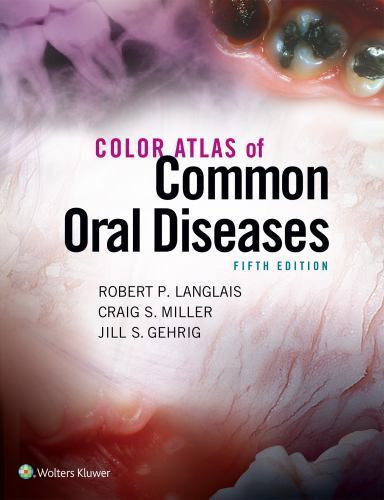 Color Atlas of Common Oral Diseases by Robert P. Langlais (2016, Trade…