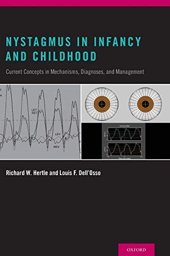 Nystagmus In Infancy and Childhood: Current Concepts in Mechanisms, Diagnoses, a